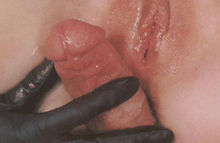 44