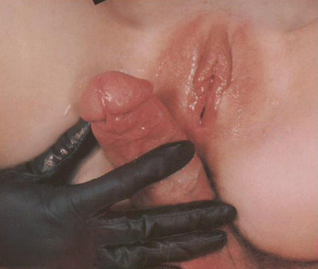 44