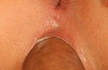 71