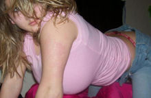 99